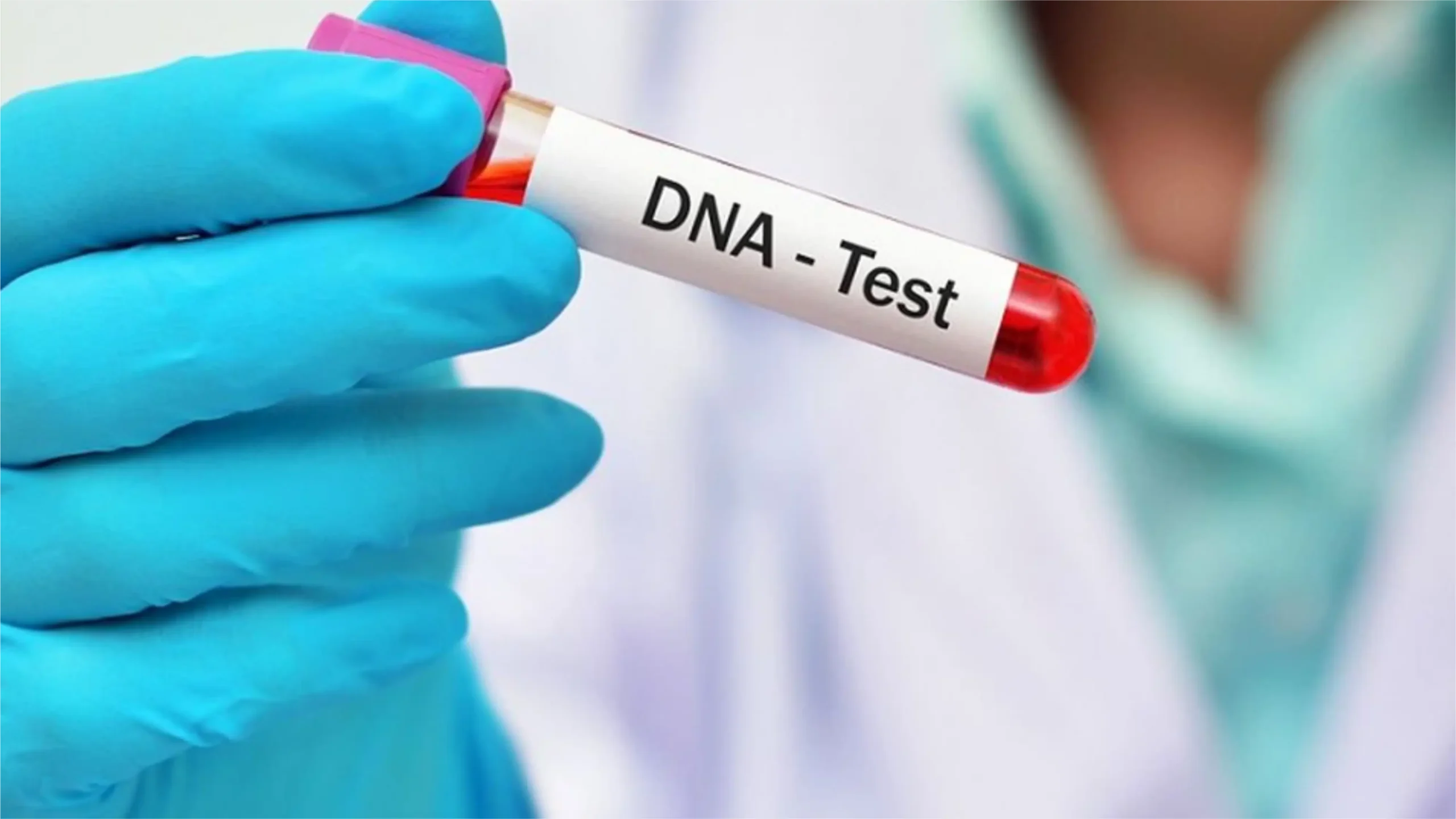 ridwan kamil tes dna
